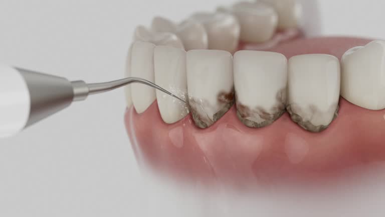 Reliable Wisdom Tooth Removal contractor in Randolph County County, AL by Dentist Open Now